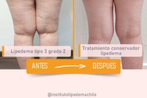Siguiente